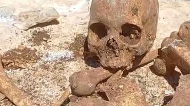 Malatya’da temel kazısında insan kemikleri bulundu